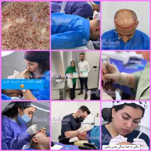 آموزش مزوتراپی و هیرفیلرمو با مدرک قابل ترجمه - آموزش کاشت مو